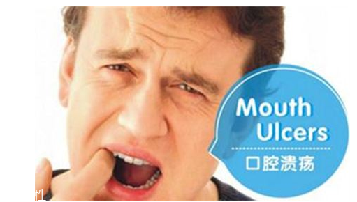 潰瘍的根源在哪里？也許僅僅只是牙膏沒選對