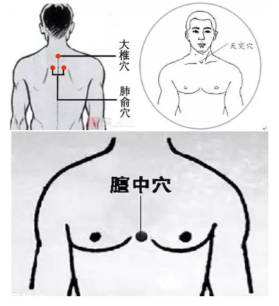 吮痧有什么療效？最溫柔的治病方法
