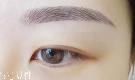 激光洗眉恢復(fù)期有疤痕怎么辦？激光洗眉毛之后正確護(hù)理方法