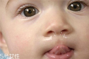 冬季寶寶流鼻涕是什么原因？教你幾招輕松應(yīng)對(duì)