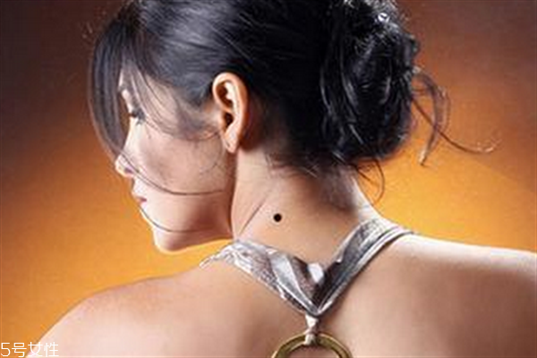 脖子后面有痣代表什么？10大身體缺陷是好事