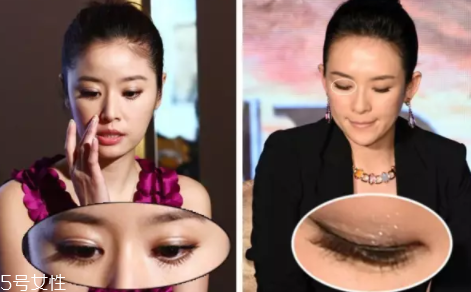內雙怎么進化成雙眼皮？全是雙眼皮貼的功勞