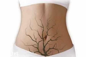 體內(nèi)毒素超標(biāo)有何表現(xiàn)？五大癥狀須注意