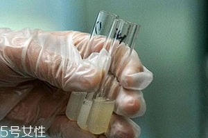 捐精有什么危害？專家稱沒有危害