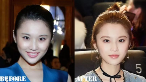 瑯琊榜2張慧雯整容了嗎？換了妝發(fā)美到不認(rèn)識(shí)