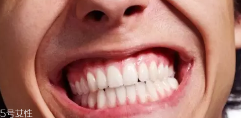 磨牙是因為受了委屈？孩子的心理狀況也會導致磨牙