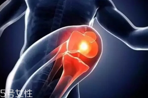 關(guān)節(jié)有響聲是病嗎？兩種情況區(qū)別對待