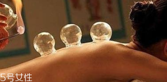 拔火罐引火上身的原因是什么？這4點要注意