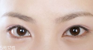 割雙眼皮的術(shù)前準(zhǔn)備有哪些？割雙眼皮的常見做法