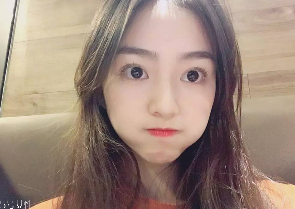 割雙眼皮要注意什么？割雙眼皮充血是正?，F(xiàn)象