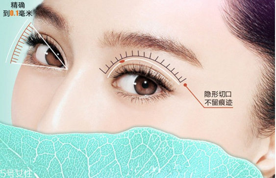 韓式雙眼皮是永久的嗎？圓眼睛不適合做雙眼皮