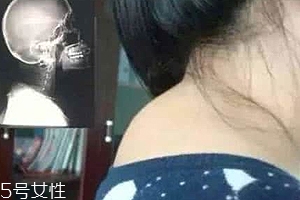 富貴包是什么??？姿態(tài)優(yōu)美少犯病