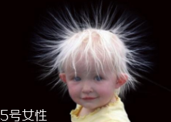 少年白什么原因？焦慮緊張會得病