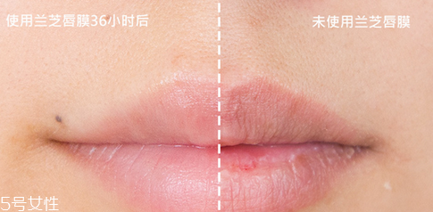 蘭芝唇膜吃進去怎么辦？擁有水嫩嘴唇