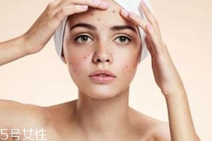 痘痘反復(fù)長(zhǎng)是什么原因？基礎(chǔ)護(hù)膚不夠用心