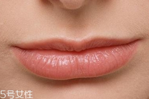 嘴唇干裂是一種病嗎？治療口角炎從改善習慣入手