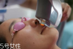 科技脫毛有哪些種類(lèi)？冰點(diǎn)脫毛不毀毛囊