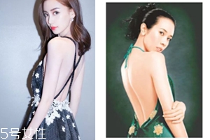 怎樣矯正背溝缺失？減肥運(yùn)動(dòng)是關(guān)鍵