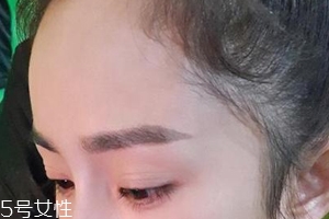 發(fā)際線(xiàn)高怎么治？拯救發(fā)際線(xiàn)攻略
