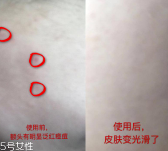 資生堂紅腰子適合什么年齡？最適合30歲以下人群
