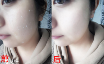 rosette去角質凝膠怎么樣？真正的去角質產(chǎn)品