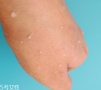 rosette去角質凝膠怎么樣？真正的去角質產(chǎn)品