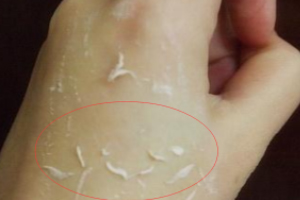 去角質凝露多久用一次？皮厚一周一次
