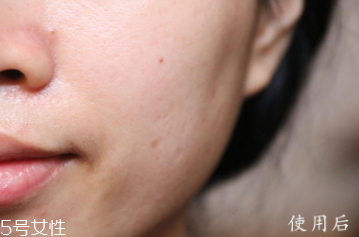 悅木之源和伊麗莎白雅頓哪個(gè)好？兩款精華大比拼
