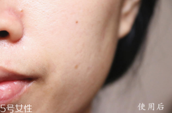 悅木之源和伊麗莎白雅頓哪個(gè)好？兩款精華大比拼