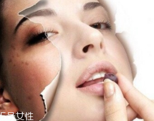 春季如何預(yù)防皮膚過敏？選擇敏感肌專用護(hù)膚品