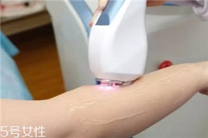 脫毛儀可以脫發(fā)際線嗎？脫了還會(huì)再長