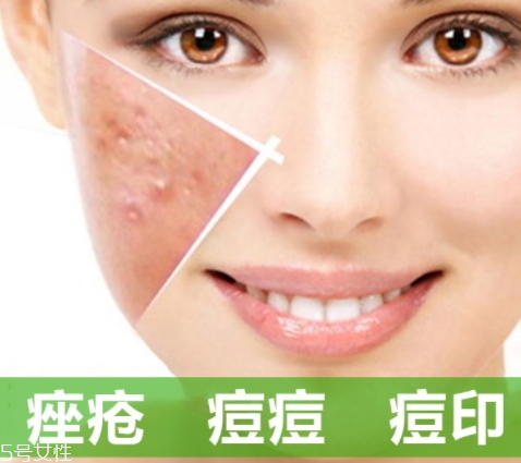 a酸怎么用？a酸怎么建立耐受？