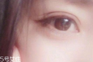 葉黃素一天吃多少毫克？按說(shuō)明服用