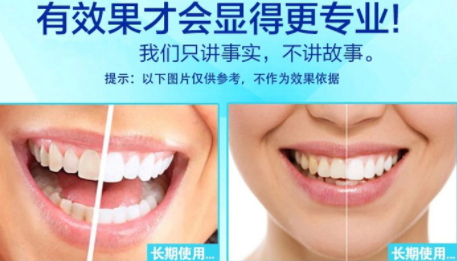 美白牙貼會反彈嗎？牙貼美白效果持續(xù)多久
