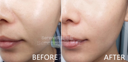 dermawand逆齡射頻注氧棒怎么用？