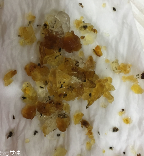桃膠能和雞蛋一起吃嗎？桃膠配雞蛋可以嗎？