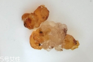桃膠可以用開(kāi)水泡嗎？用開(kāi)水泡桃膠好嗎？