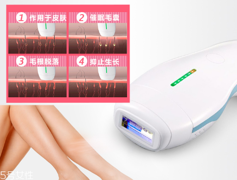 deess脫毛儀多少錢？蒂絲脫毛儀價格