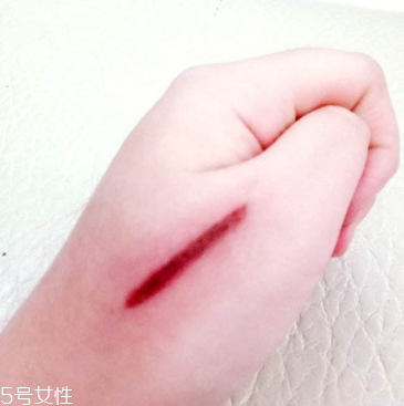創(chuàng)可貼和肉連著怎么辦？創(chuàng)可貼連著肉怎么處理？