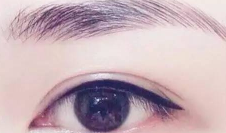 提眉和雙眼皮一起做嗎？提眉和雙眼皮要隔開多久