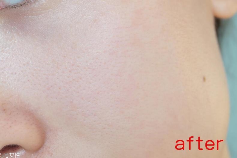 radha beauty vc精華白天能用嗎？敏感肌能用嗎？
