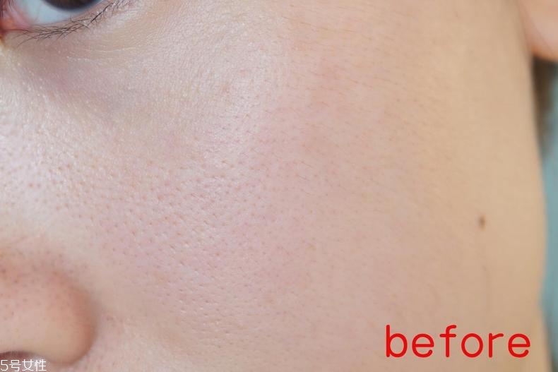 radha beauty vc精華白天能用嗎？敏感肌能用嗎？