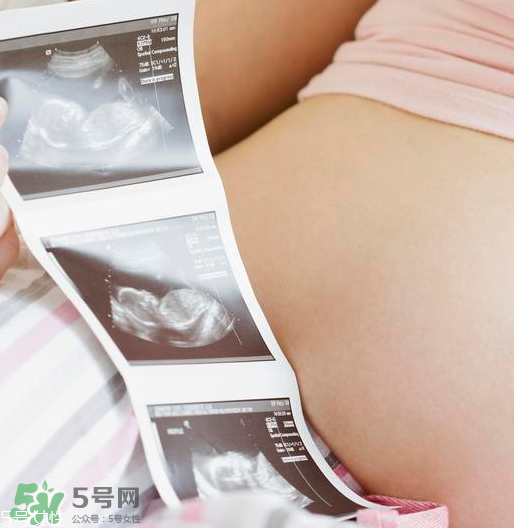 頭胎雙胞胎還能生二胎嗎？雙胞胎家庭能要二胎嗎？