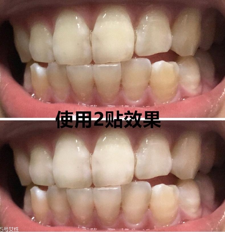 佳潔士美白牙貼貼多久有效？佳潔士美白牙貼使用感受
