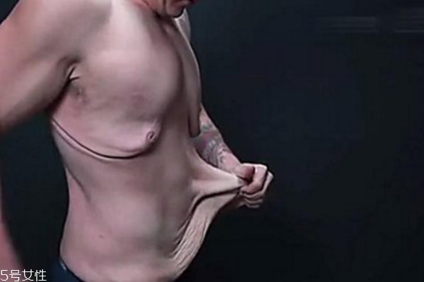皮膚松弛，你應該為肌膚補充營養(yǎng)