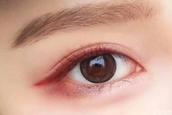 開內(nèi)眼角眼睛會變大嗎 開內(nèi)眼角恢復過程