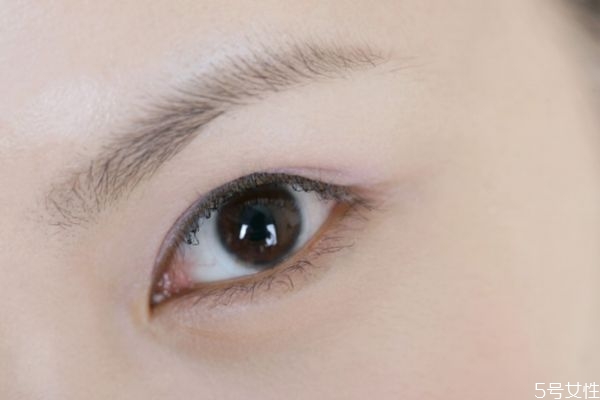 開內(nèi)眼角眼睛會變大嗎 開內(nèi)眼角恢復過程