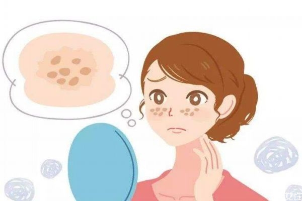 為什么有的孕婦會(huì)長斑呢 造成孕婦長斑原因是什么呢