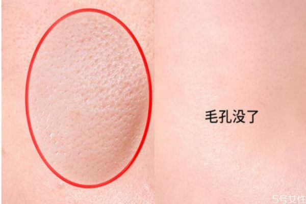 有什么護(hù)理收縮毛孔的方法 最簡單的收縮毛孔方法