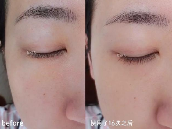 護膚與不護膚的區(qū)別圖 護膚與不護膚的對比差距大嗎